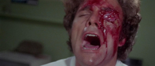 The Case of the Scorpions Tail 45